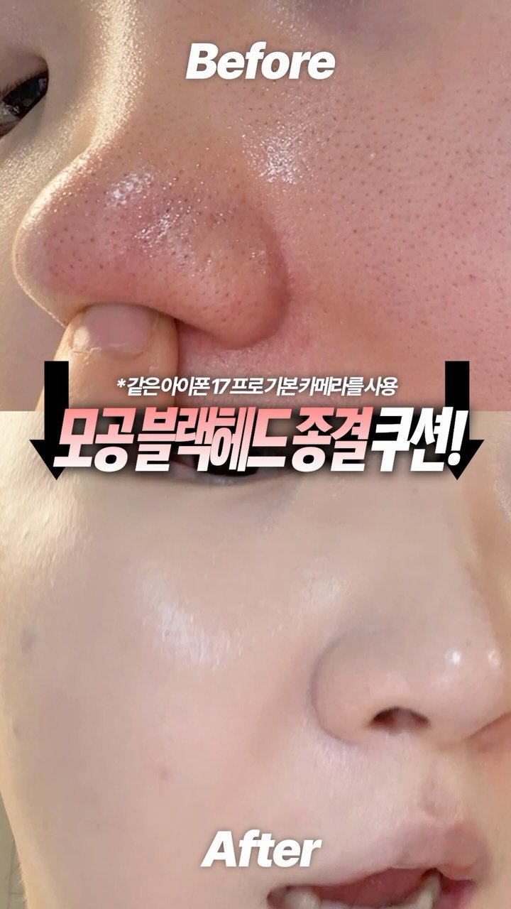 toxin1204 게시물 이미지: 💚파넬 시카마누 세럼 인 매트 쿠션 2.0 톡신 공동개발 마켓💚
📌 마켓 기간 :...