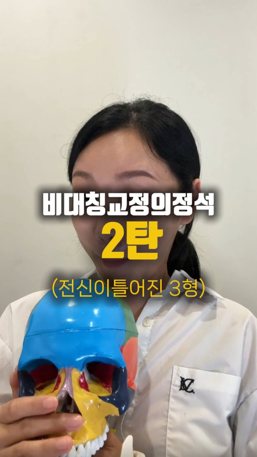 treed_ofcl 게시물 이미지: 만약 입꼬리와 광대 ,콧구멍이 올라간쪽의 볼이 넓다면
근육이 발달되거나 
광대밑...