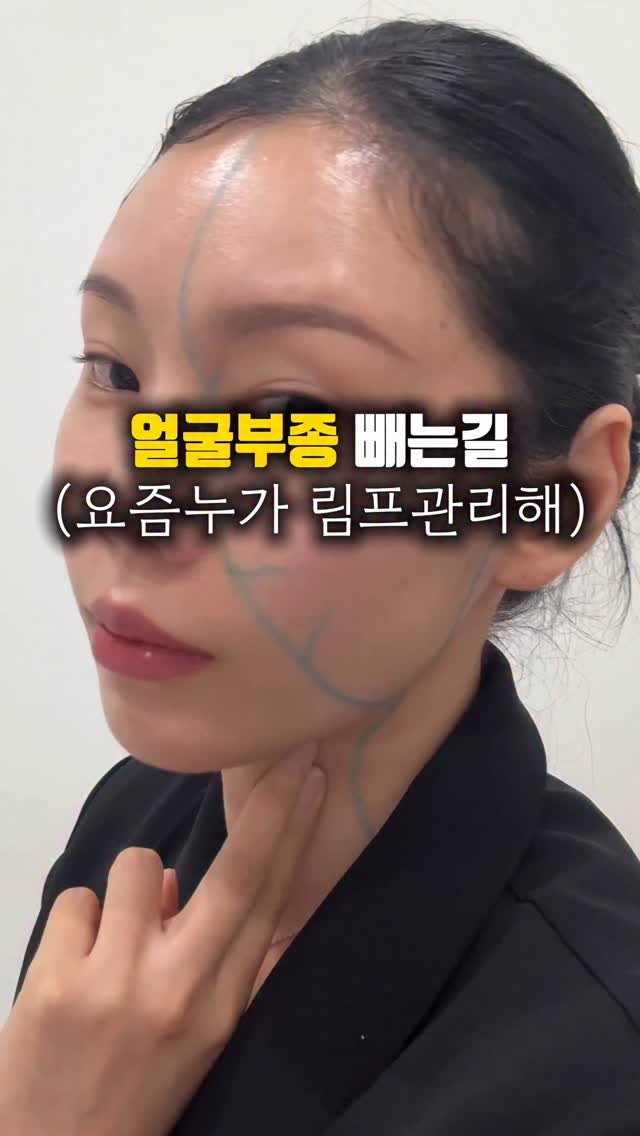 treed_ofcl 게시물 이미지: 얼굴에 필러나 뭔가를 넣는 시술을 하신분들!
윤곽관리 유지력을 높히고...