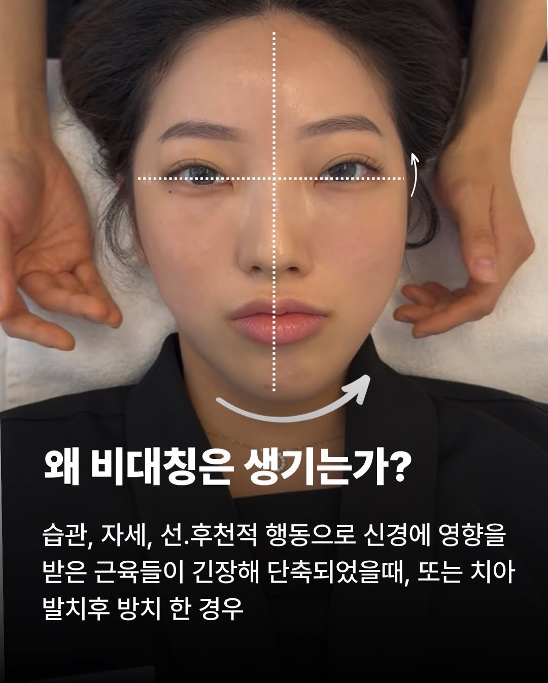Photo by 강남 리프팅전문샵 트리드스파 ㅣ 최원장🇰🇷 on December 27, 2025. May be an image of text that says '왜 비대칭은 생기는가? 습관, 자세, 선.후천적 행동으로 신경에 영향을 받은 근육들이 긴장해 단축되었을때, 또는 치아 발치후 방치 한 경우'.