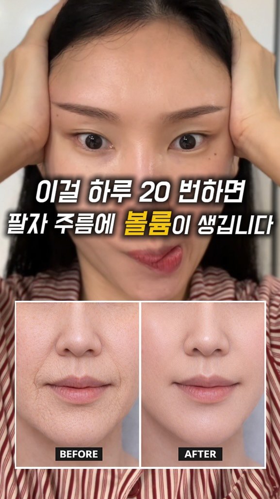 treed_ofcl 게시물 이미지: ❣️ 자기전에 팔자주름 관리하구자요 ! 

관자놀이에 텐션주고 
입술을 양쪽으로...