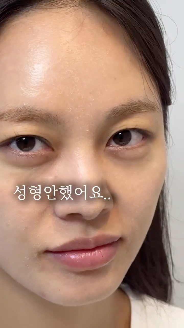 treed_ofcl 게시물 이미지: 나 진짜 건조하고 얼굴작아지고싶다 손👋🏻

팔자주름,이마주름,폭풍물광에
광대...