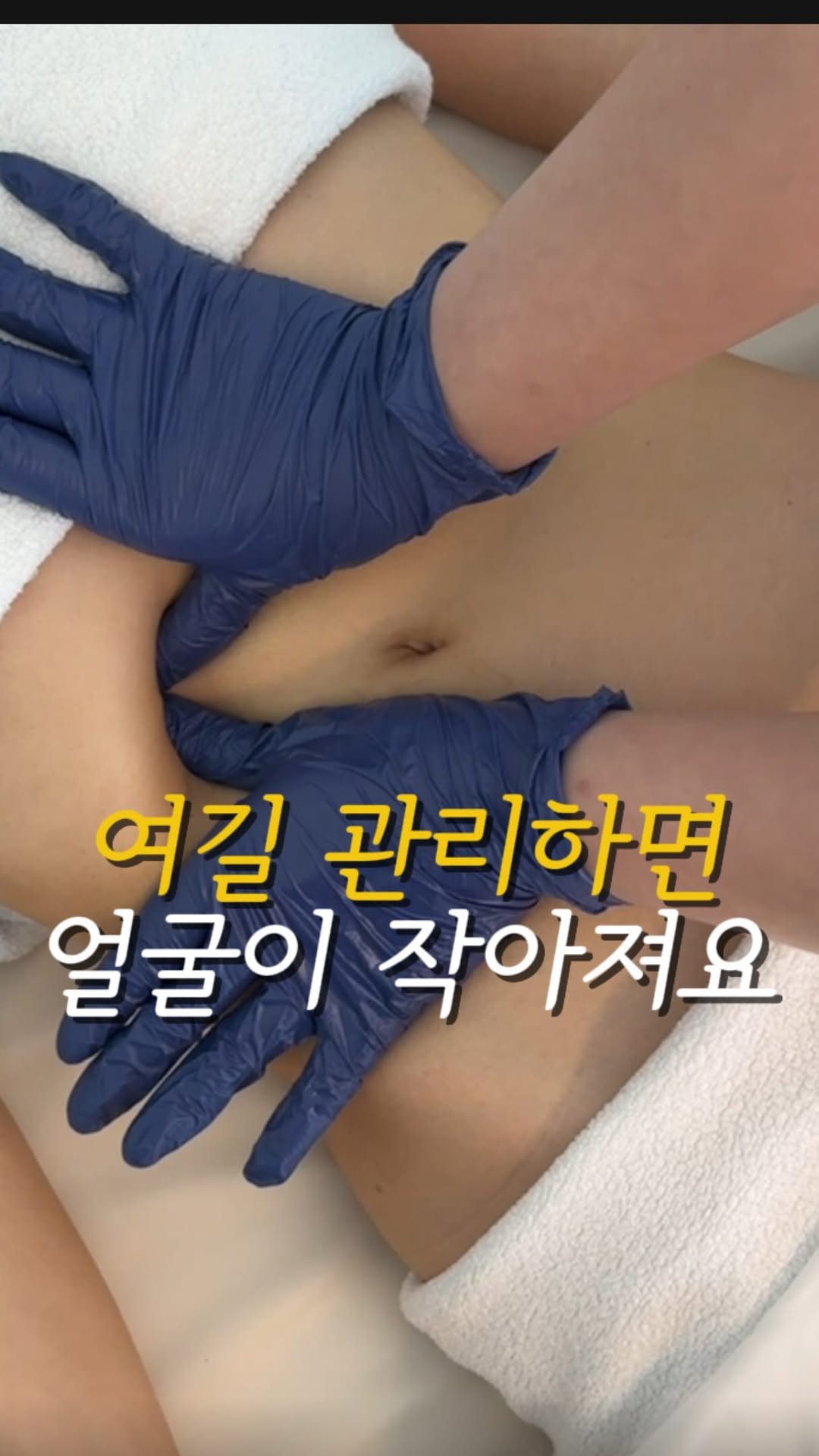 treed_ofcl 게시물 이미지: 댓글에 “교정” 남겨주세요 ! ✨

얼굴작아지는 포인트 ! 
바로 라운드숄더 관리죠...