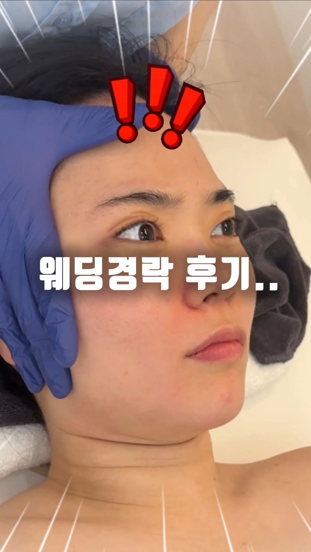 treed_ofcl 게시물 이미지: ️👰🏻‍♀️웨딩경락 1회 관리 후기
 
섬세한 수기로 비대칭과 얼굴축소를 
동시에...