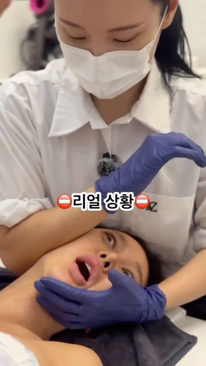 treed_ofcl 게시물 이미지: 💎 얼굴이 한쪽만 더 갸름하다구요?
사진 찍을 때, 거울 볼 때마다 신경쓰이는...