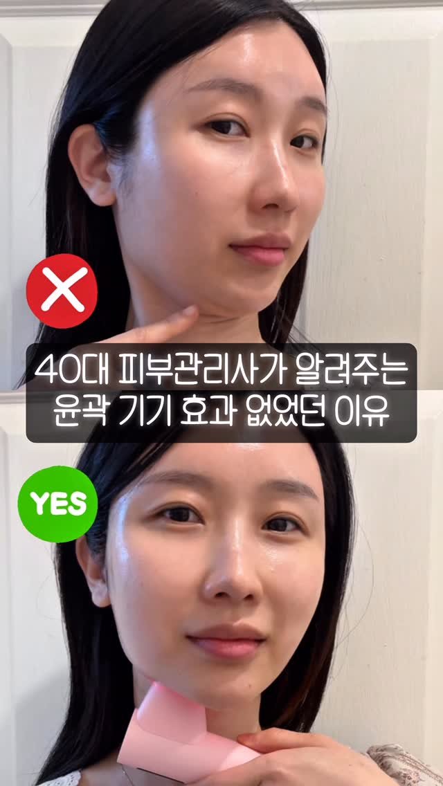 true_sister85 게시물 이미지: 윤곽은 초음파라고 해서 무조건
관리되지 않아요.🙅🏻‍♀️
⠀
피부 깊숙이 있는...