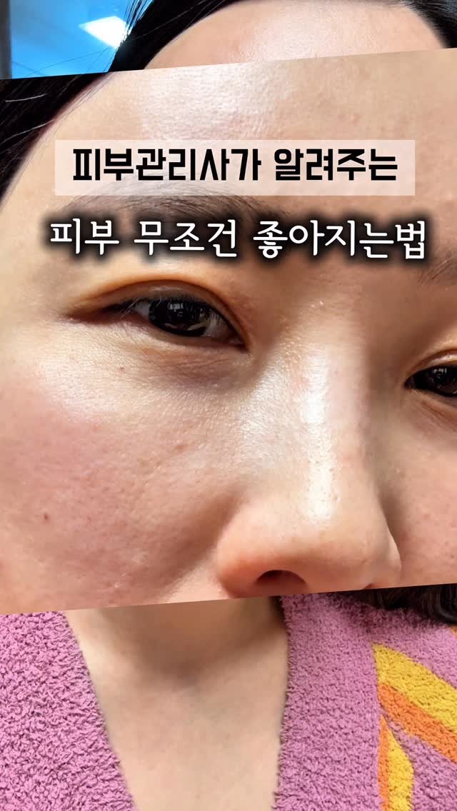 true_sister85 게시물 이미지: 요즘 피부가 좀만 자극 받아도 
바로 뒤집어지는 분 들 많죠...
저도 요즘 환절기...
