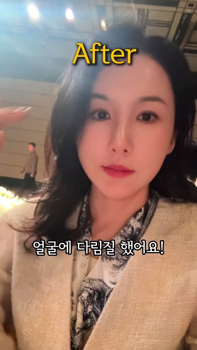 ttasa_roi 게시물 이미지: 오랜만에 관리 후기🔥

그동안 여행 다니느라
전 세계의 자외선을 흡수하고 다니다...