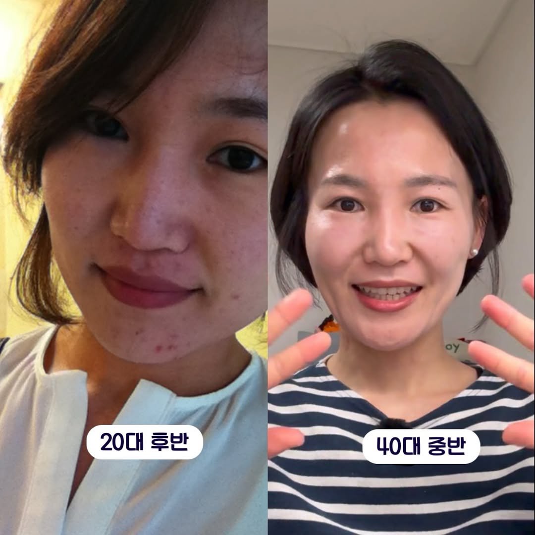 Photo by 안채연 어글리레몬| 푸드컨설턴트  | 우리가족 보약 스무디 on February 22, 2026. May be an image of one or more people, hair and text that says '20대 20대후반 후반 40대중보 40대 중반'.