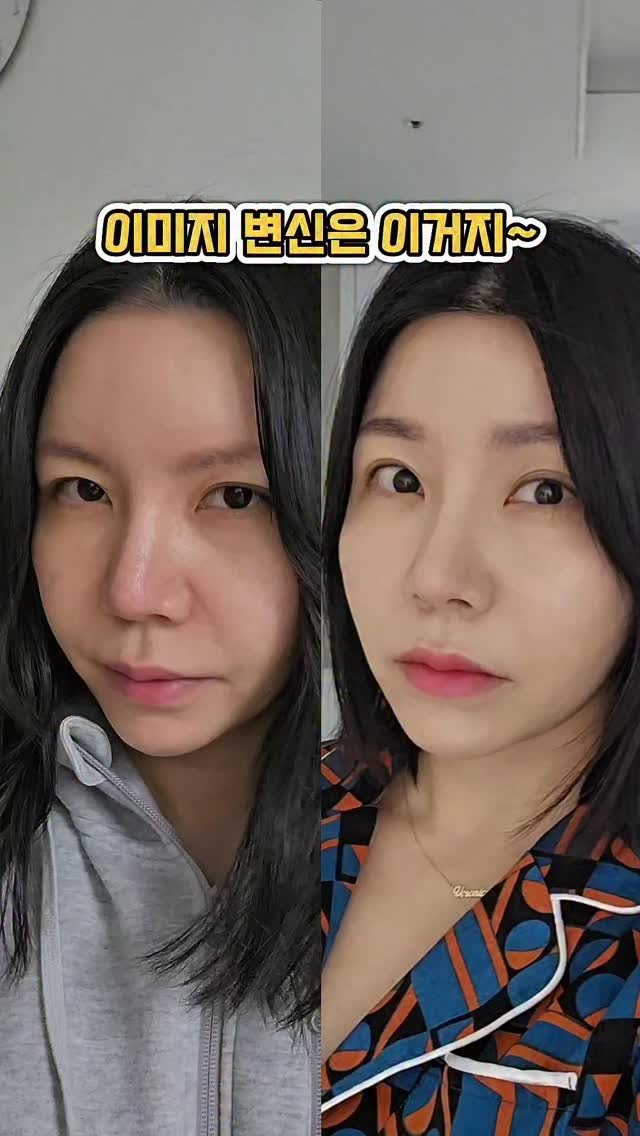 veronica.sh 게시물 이미지: 이마 축소 + 거상 6개월차

솔직히 말하면…
초반엔 어색하고 붓기도 있었어요
근데...