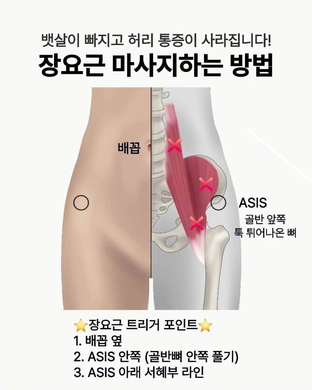 Photo by 민스🌸 40대/홈트/요가/순환관리 on June 12, 2025. May be an image of text that says '뱃살이 빠지고 허리 통증이 사라집니다! 장요근 마사지하는 방법 배꼽 ASIS 골반 골반앞쪽 앞쪽 툭 튀어나온 뼈 장요근 트리거 포인트 1. 배꼽 배꼽옆 옆 2. ASIS 안쪽 (골반뼈 안쪽 풀기) 3. ASIS 아래 서혜부 라인'.