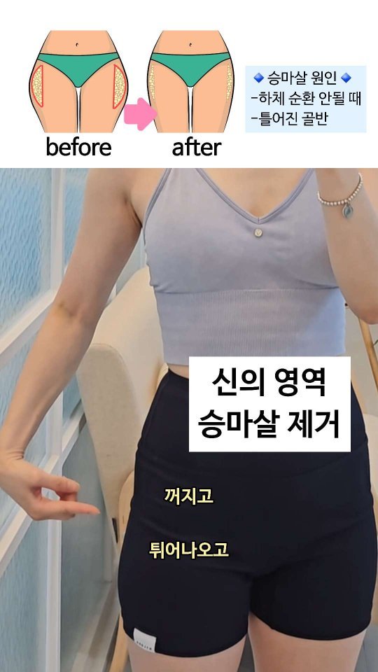 viveza_mins 게시물 이미지: 🥶신의 손길(?) 인정... 옆툭튀 승마살, 진짜 빠집니다
1️⃣ 순환이 안 되면...