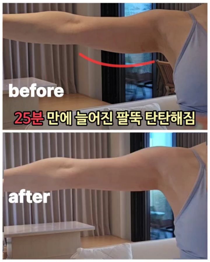 viveza_mins 게시물 이미지: 아령 100개한 효과!! 25분만에 덜렁거리던 팔뚝이 탄탄💥 누워만 있었을...