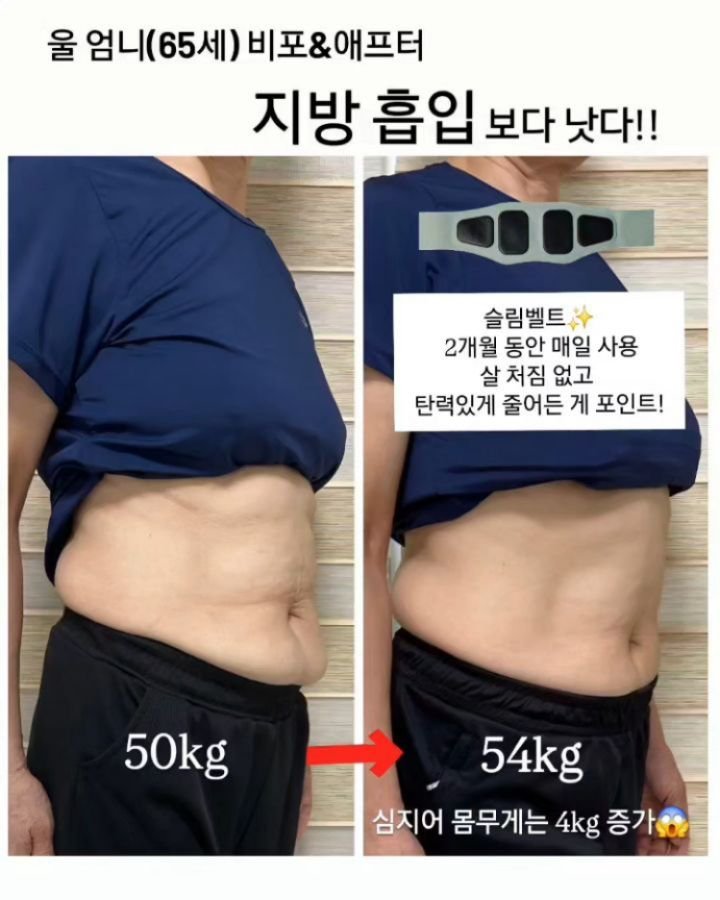 viveza_mins 게시물 이미지: 진짜 뱃살 빠지나요? 65세 할미 늘어진 뱃살도 이렇게 탄탄해져요😱

살이...