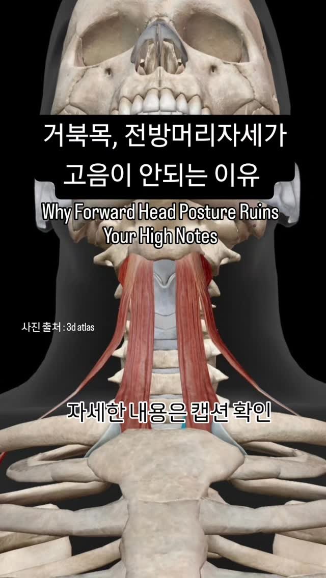 vocal_physio 게시물 이미지: 🐢거북목, 전방머리자세(FHP)가 고음이 안되는 의학적 이유? 

🌟본 포스팅은...