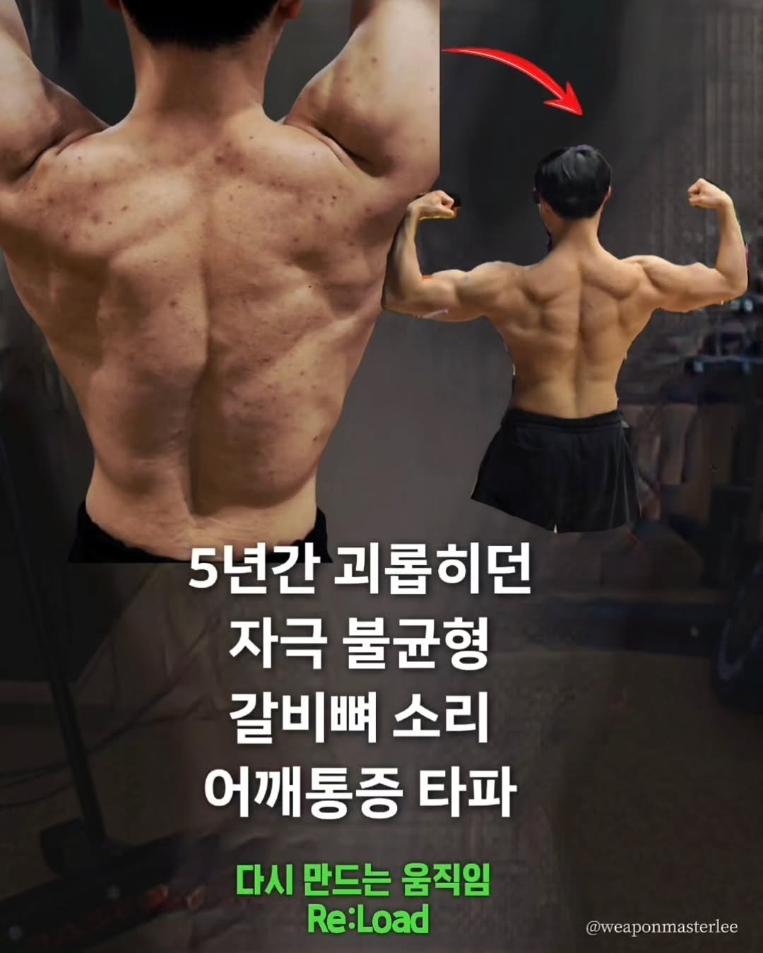 weaponmasterlee 게시물 이미지: 5년동안 해결되지 않던
등·가슴 자극 불균형, 갈비뼈 소리, 어깨 통증, 비대칭...