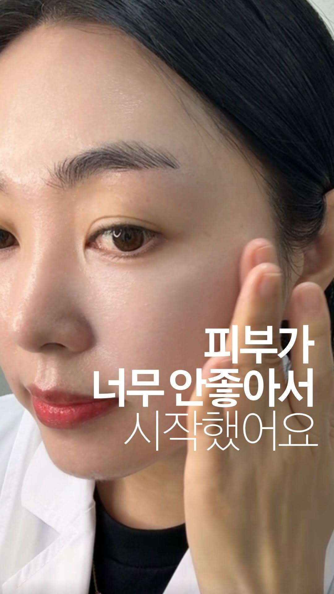 well.come.anna 게시물 이미지: 정말 처음 시작은
피부가 너무 안좋아져서 였어요🥲

점점 심해지는 홍조와...
