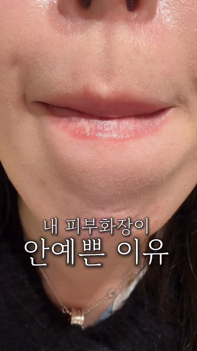 wendy_w_skin 게시물 이미지: 피지정리가 하나도 안되어있을때

모공마다 과잉피지로
화이트헤드 콕콕...