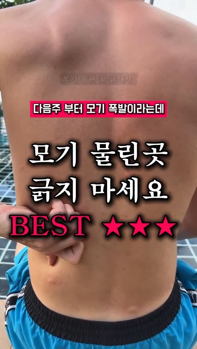 what._.living 게시물 이미지: 모기 물리면 자동으로 긁적… 새벽에 피 맺힌 적 있죠?
간지러워도 참다 참다 결국...