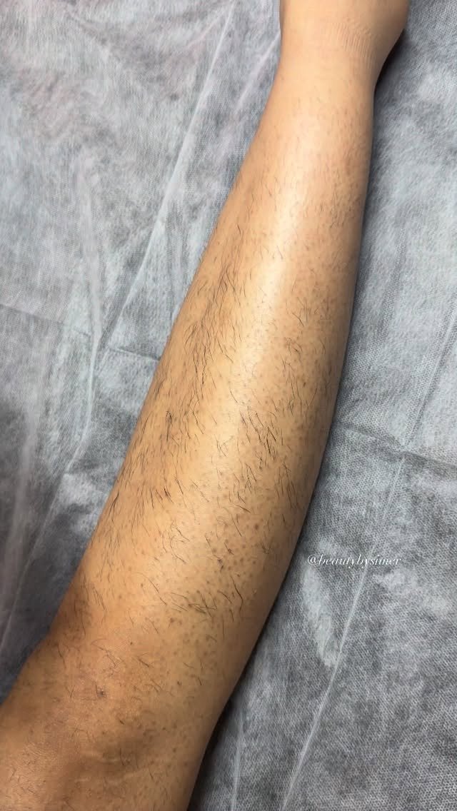 winnipeg_beauty_by_simer 게시물 이미지: Dm for hydrafacial, laser ,mehndi henna,...