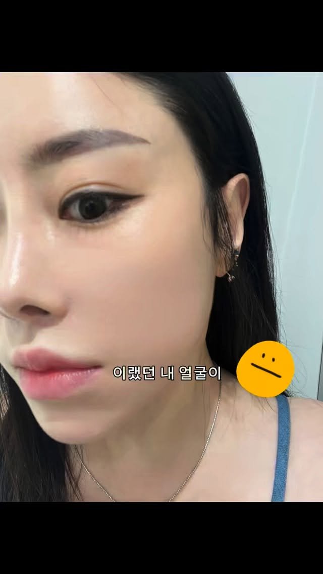 withrose_zip 게시물 이미지: 나이도 나이지만~
최근에 살이 너무 많이찌면서 
얼굴이 무거워서 밑으로 쳐지니...