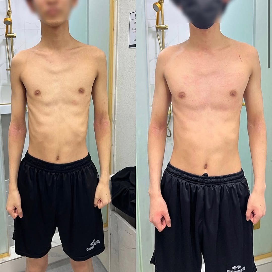 wjdfufl 게시물 이미지: 📌체중증가 목표 20대 남성회원님 비포애프터

먼저 어머님이 맘카페 추천글을 보고...