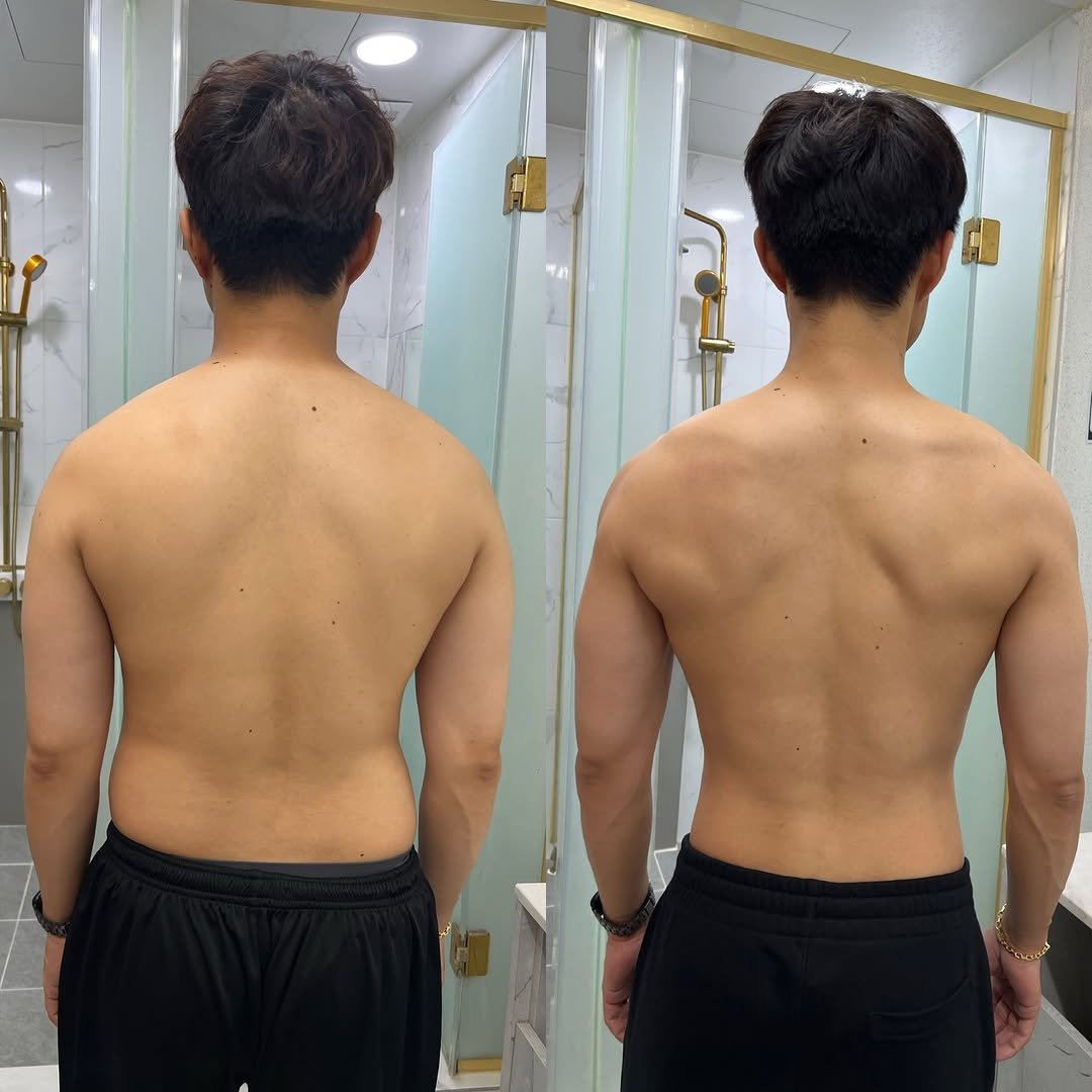 wjdfufl 게시물 이미지: 📌바디프로필 30대 남성회원님 3개월 변화

9월 11일 78.5kg
12월 17일...