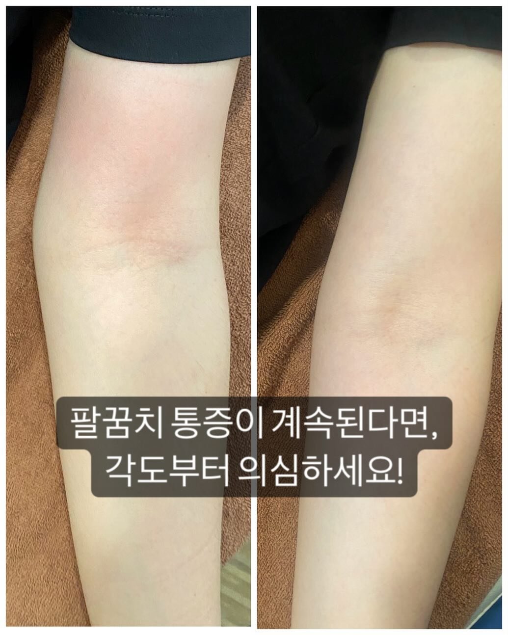 Photo by 김민주 | 도수 물리치료사 on June 12, 2025.