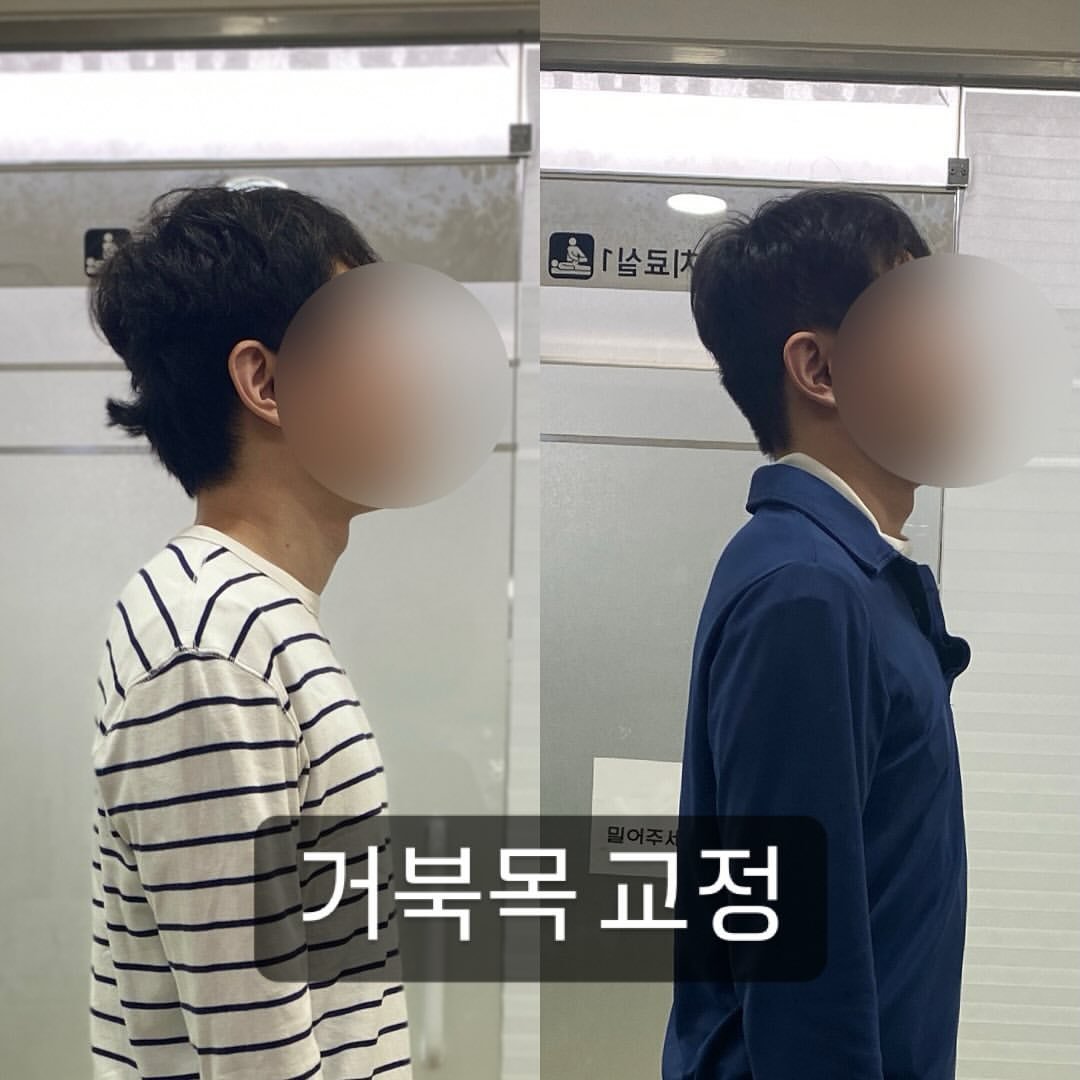 Photo by 김민주 | 도수 물리치료사 on November 26, 2024.