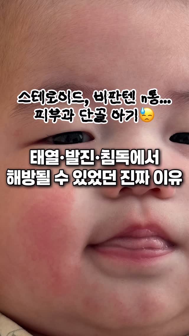 xoxo.siwoo 게시물 이미지: Q. 시우맘. . 라무르 언제 다시 열어요?🥹
‼️ 재구매율 200%, 효과는...