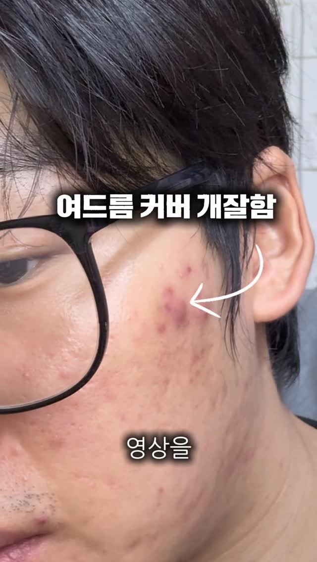 xunwo0o 게시물 이미지: 여드름커버 이거보다 더 잘 할 순 없다
.
.
.
#makeup #메이크업 #여드름