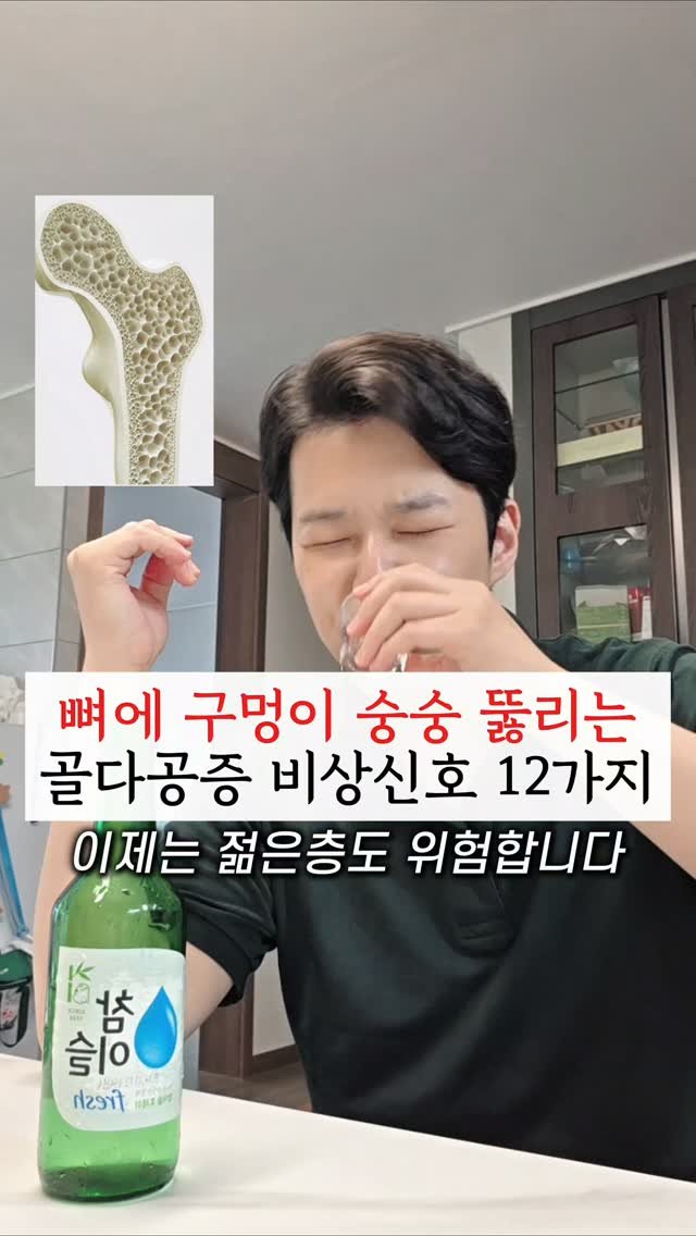yak_secret 게시물 이미지: 🔻3개이상 해당하신다면 확인해주세요🔻

노인성 질환이라 여겨지던 골다공증이 🦴
점점...