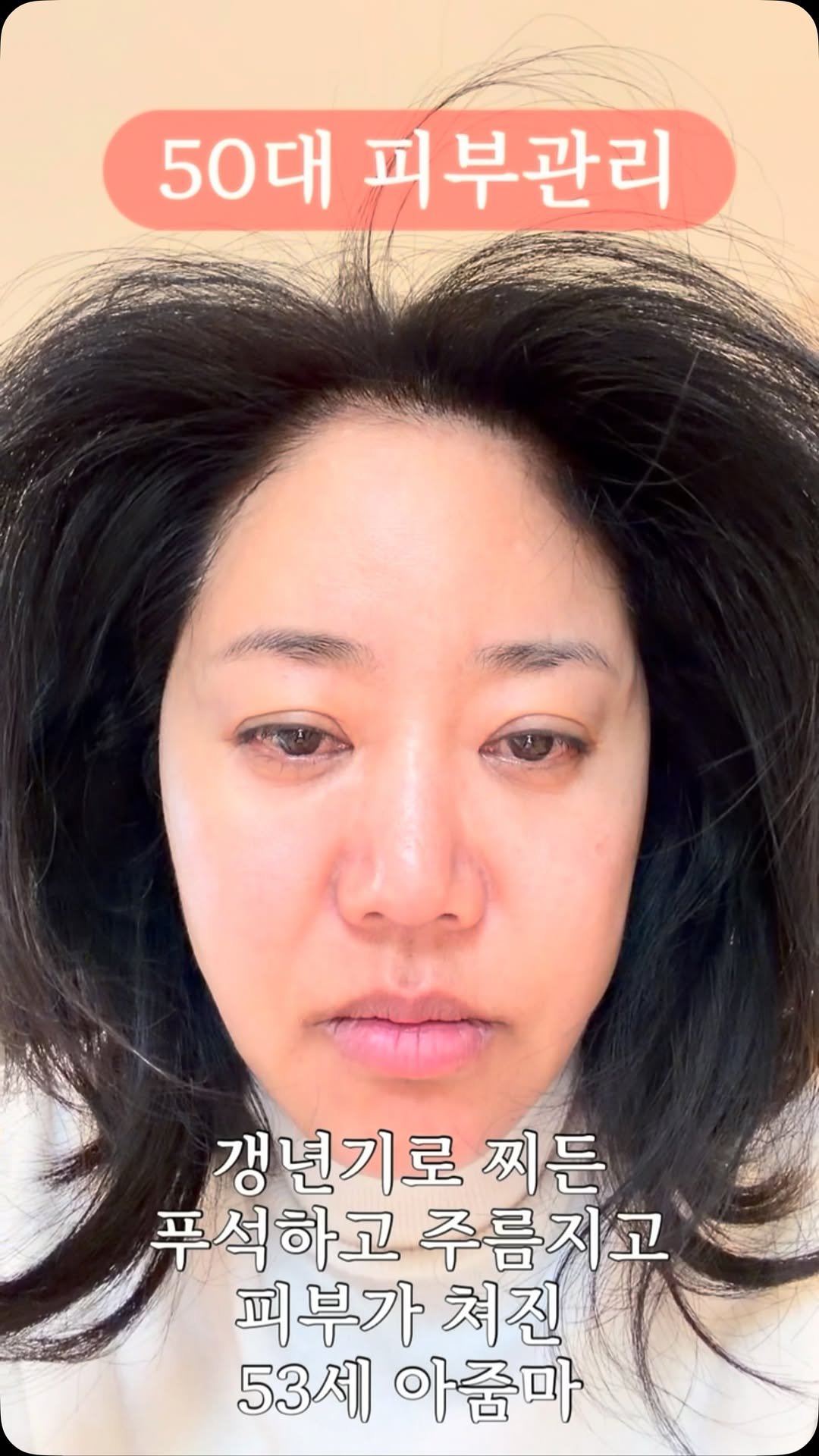 yeahfur 게시물 이미지: .
50대 피부관리
매번 피부과 갈수도없고
관리도 귀찮고
그 마음 제가 잘...