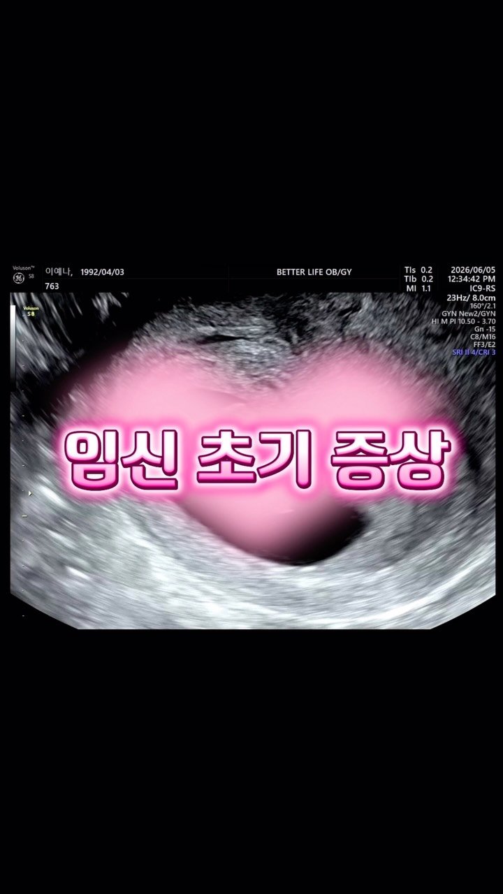 yena_ssam 게시물 이미지: 둘째 임신🔥🔥
행복하긴 한데^.^…. 
첫째때보다 어찌 입덧 너무...