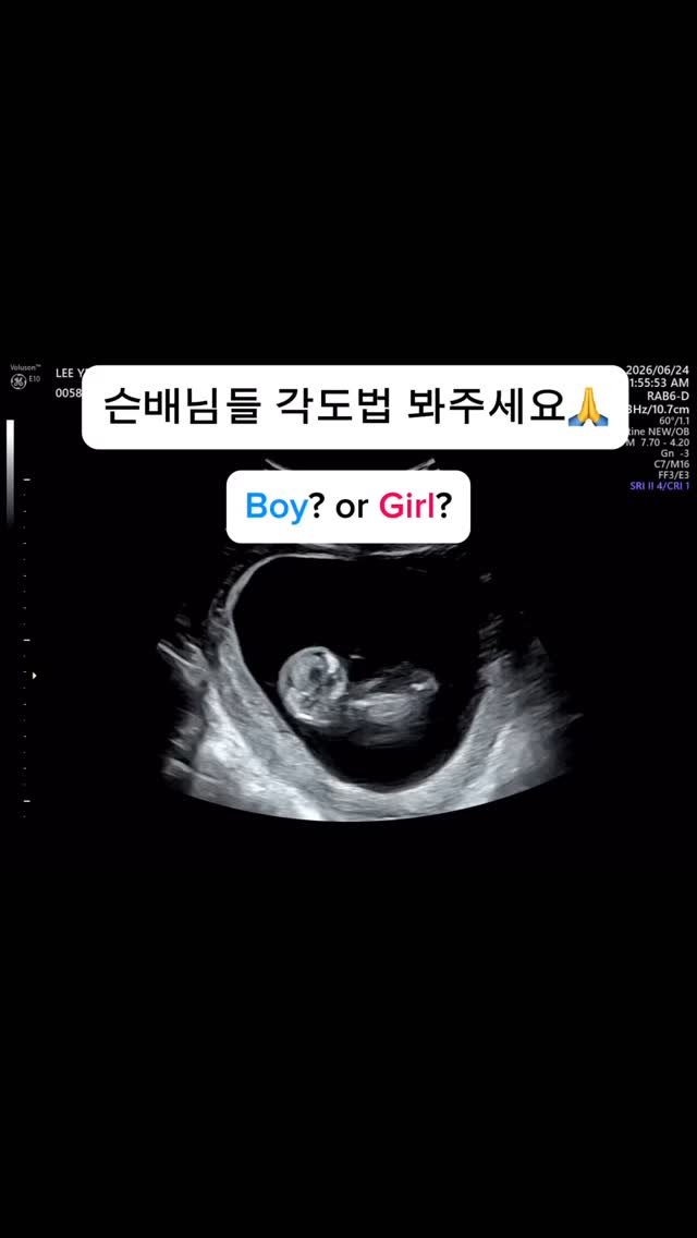yena_ssam 게시물 이미지: 슨배님들 울 토마 각도법 봐주세요💖
아들?! 💙vs 딸?!🩷

지금까지 저희 모~든...