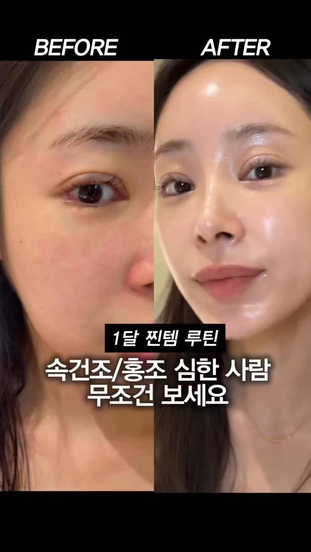 yeonpilates 게시물 이미지: 홍조/속건조 인들 무조건 보세요
요즘 속건조 + 홍조 때문에 피부 예민해진 분들...