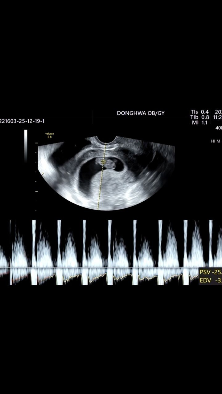 yogini_su_12 게시물 이미지: #헬요커플 #헬요부부

우리 2025년에 열심히 살아왔네!!
우리 내년에는 더...