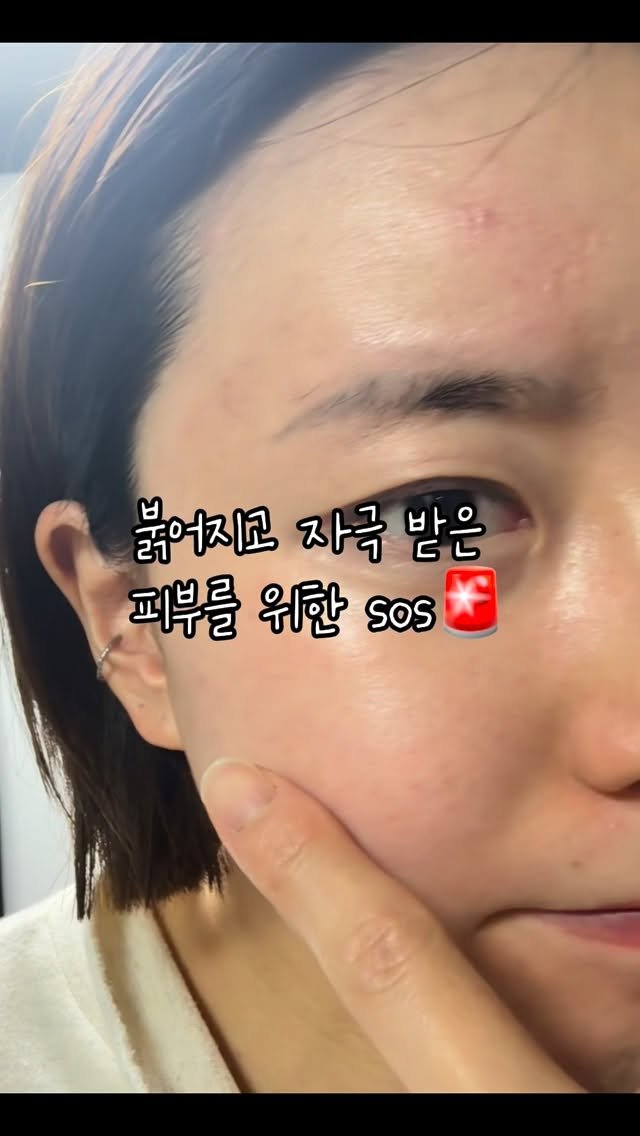 yogini_su_12 게시물 이미지: #광고
일본여행 후 물갈이 야외활동으로 자극 받은 피부를 위한 
긴급처방!! 시카...