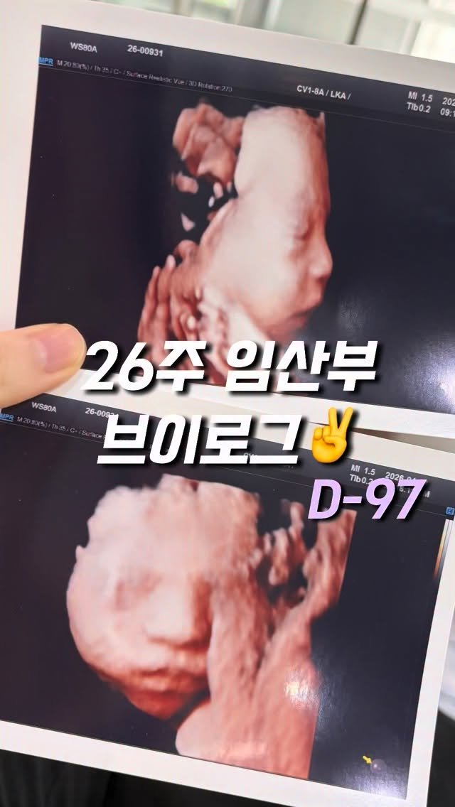 yoomnique 게시물 이미지: 어느덧 26주차‼️

#임신중기 #임신7개월 #임신26주 #임산부운동