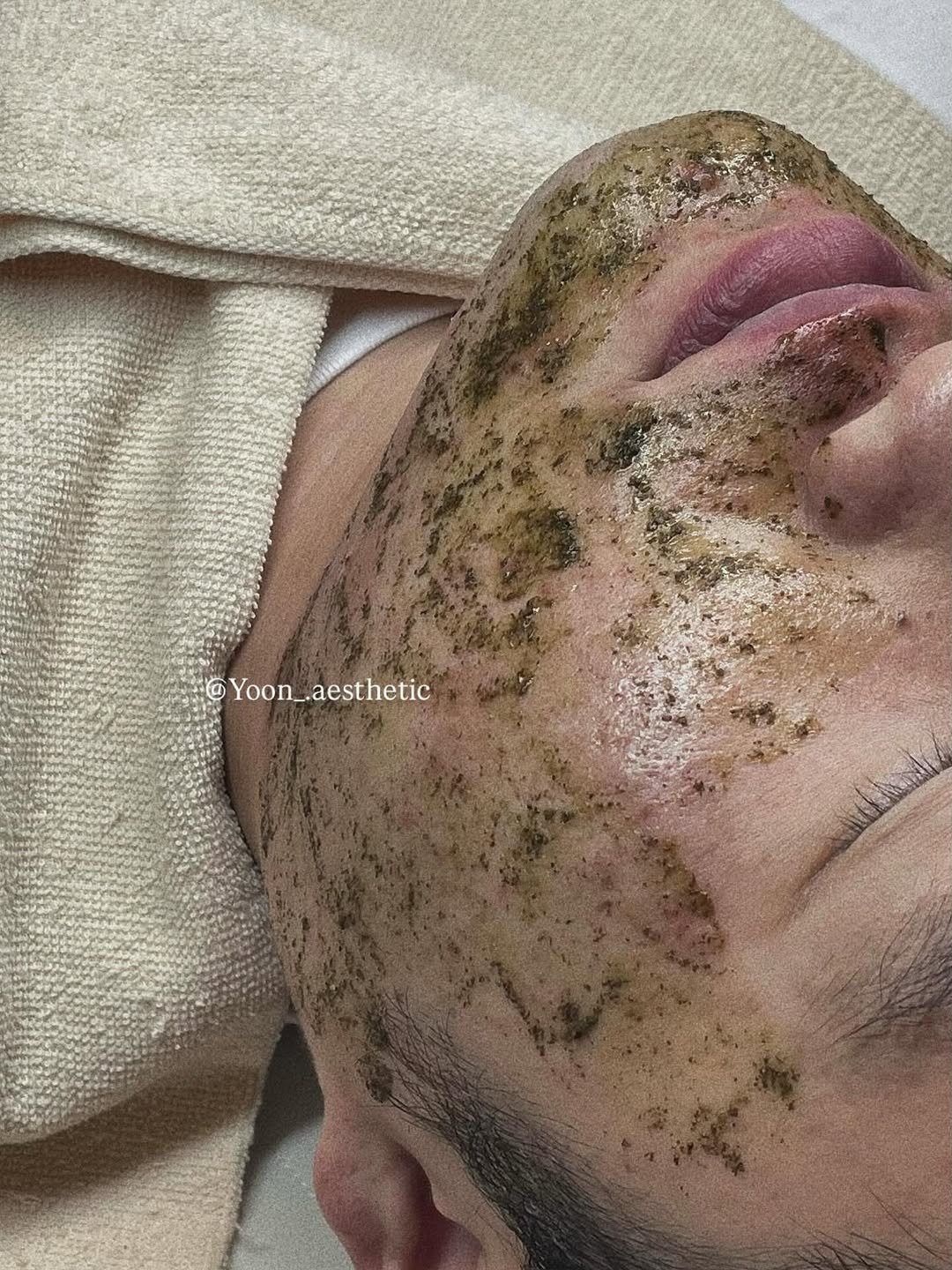 Photo by 파주문산 피부관리 : 윤에스테틱 | 문산에스테틱 • 파주피부관리 • 금촌피부관리 in 파주 당동리. May be an image of 1 person.