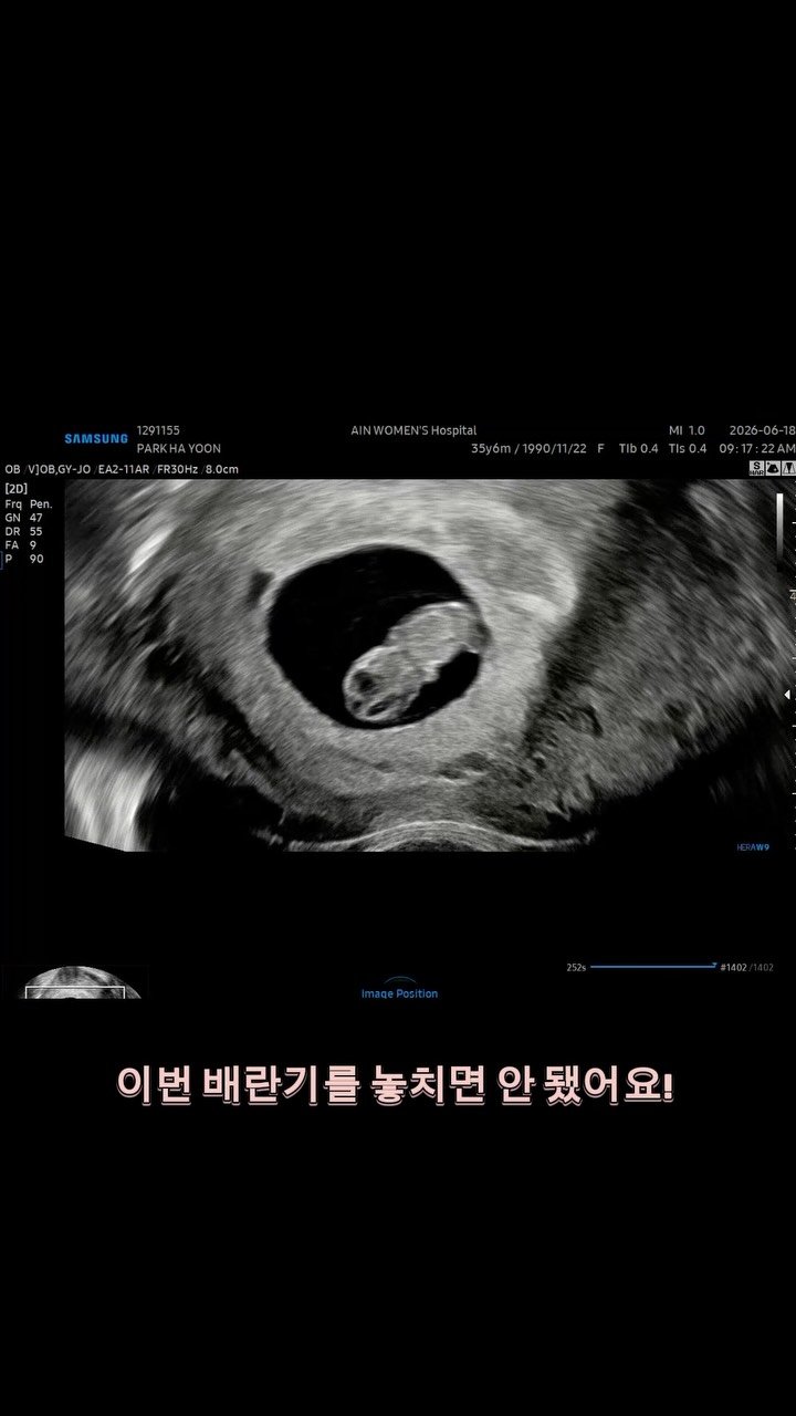 yoon_pilates 게시물 이미지: 1월생 아기를 계획하고 있었던 저는
이번 배란기를 꼭 놓치고 싶지 않았어요...