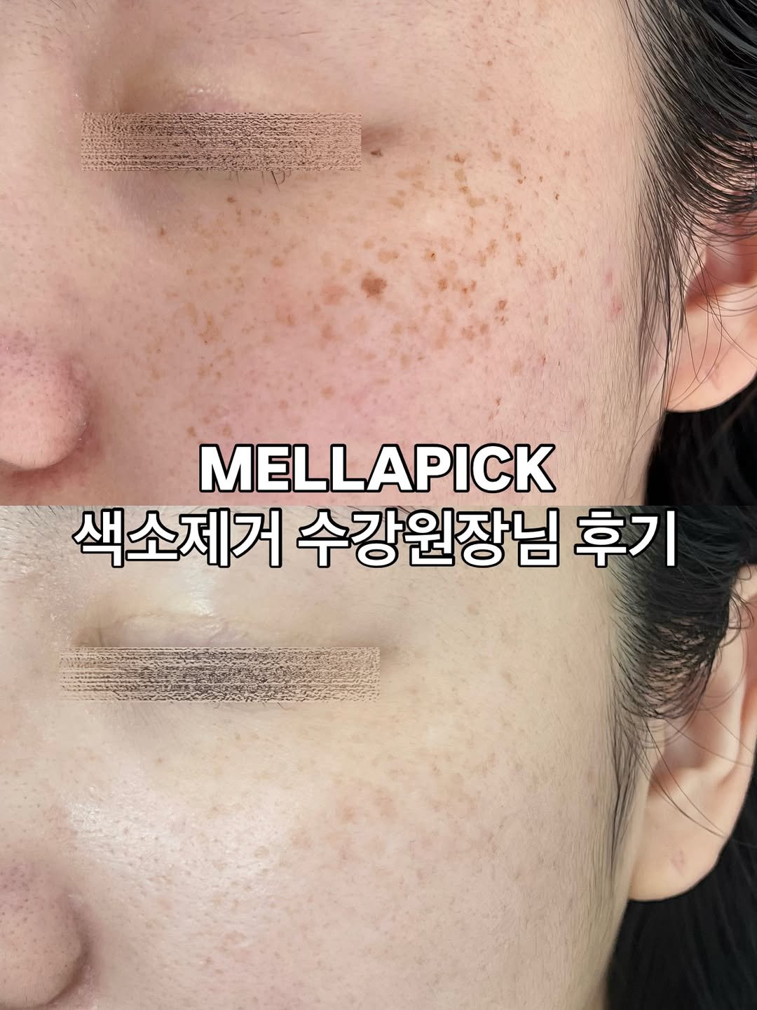 멜라픽