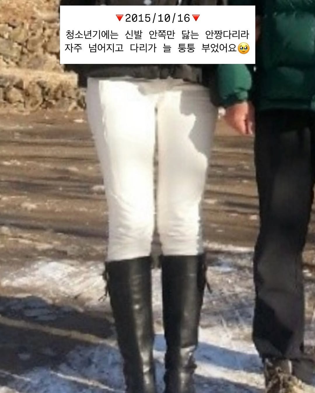 Photo by 윤지어트 | 다이어트• 자기관리 on September 28, 2025. May be an image of 2 people, people standing, boots, parka, snow and text that says '2015/10/16 청소년기에는 신발 안쪽만 닳는 안짱다리라 자주 넘어지고 다리가 늘 퉁퉁 부었어요'.