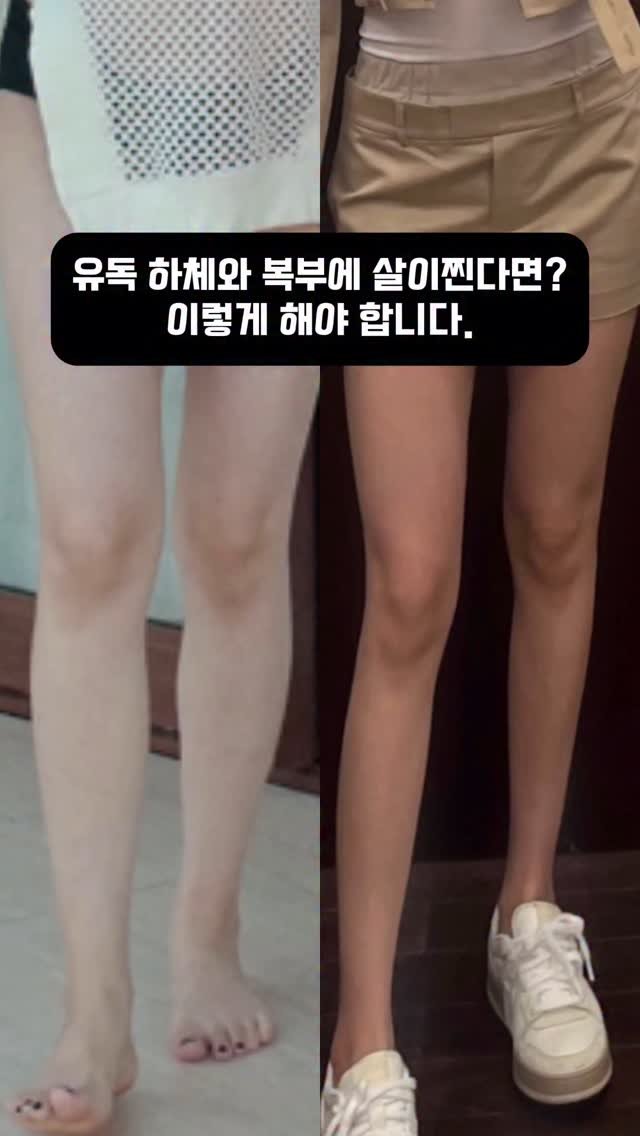 yoonjiet_ 게시물 이미지: ✅ 발목부터 허벅지까지 단계적인 압박을 가진 의료기기 압박밴드는 혈액 순환을...