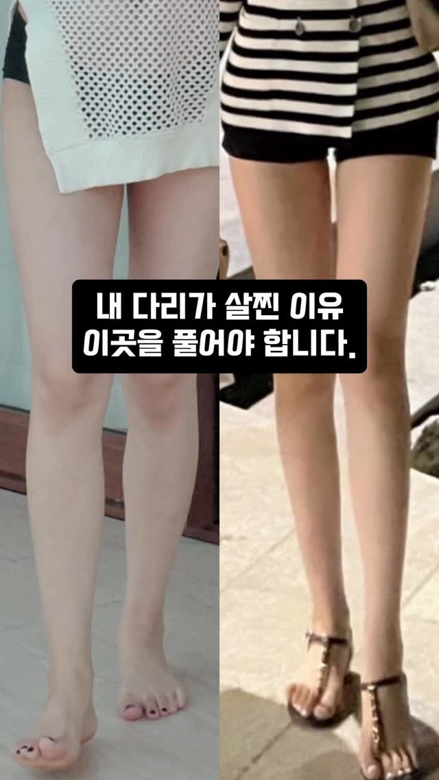yoonjiet_ 게시물 이미지: 🔻다리 순환과 부종은 물론 라인 교정까지 도와주는 슬룸 EMS 슬리퍼 프로필 상단...