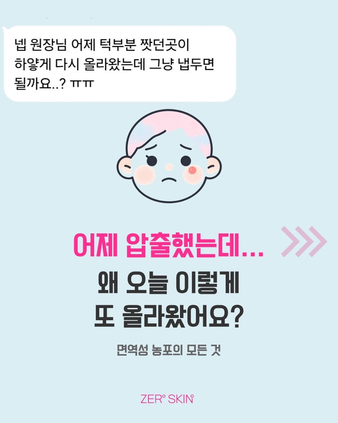 zero_skin 게시물 이미지: 압출했는데..이렇게 올라왔어요.
건들지 말까요? 염증주사...