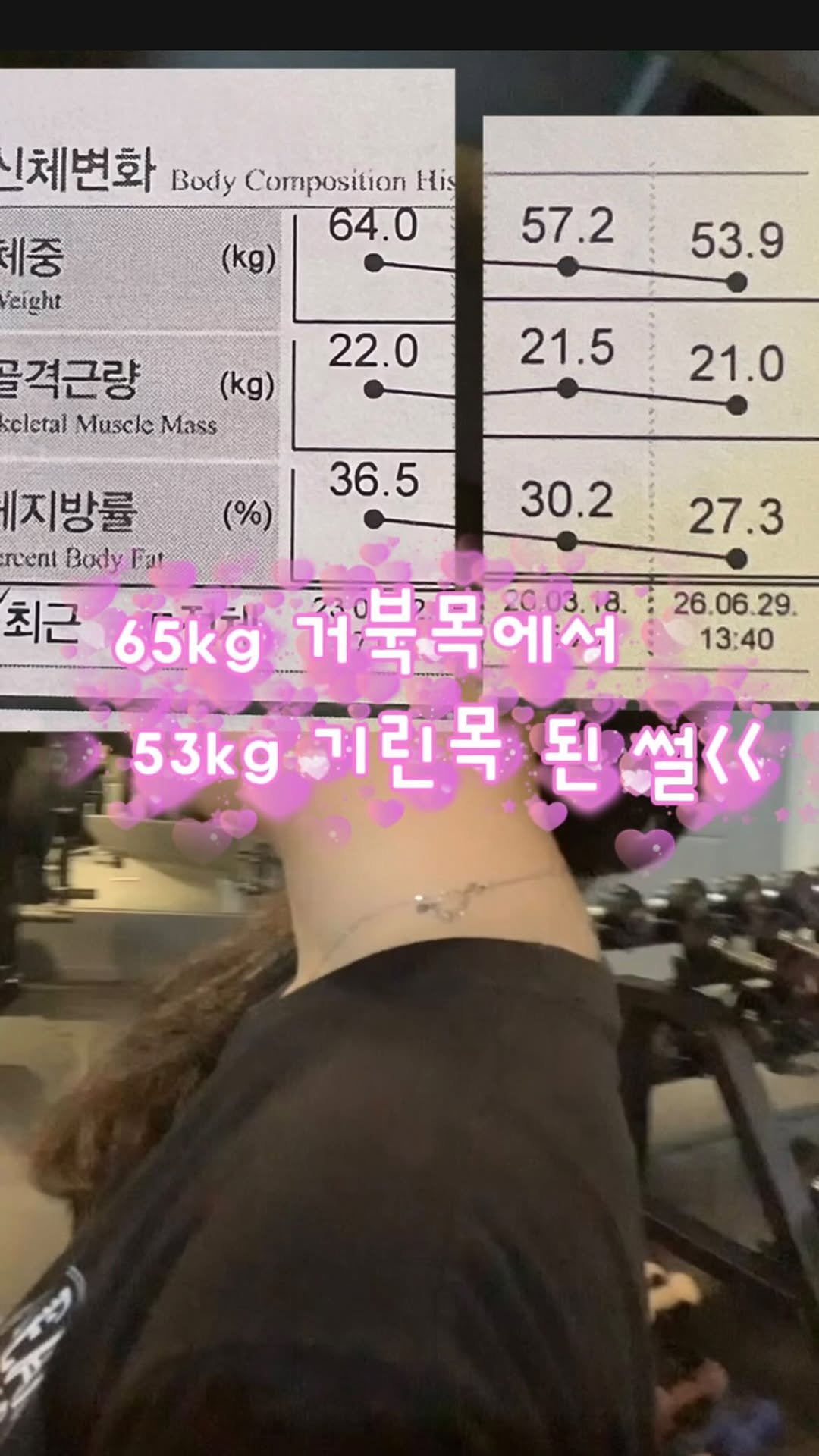 zonieter 게시물 이미지: 거북목 교정의 끝은 기린이었다 ..!

3년 전 영상을 다시 보고
회원님도, 존티도...